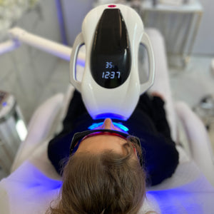 Christmas Sale - Gutschein für ein Bleaching vor Ort